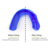 SISU 3D Mouthguard showing before and after fitting.